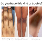 Women's Skin Pigmentation Care